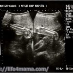 妊娠29週目のエコー画像