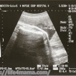 妊娠38週目のエコー画像