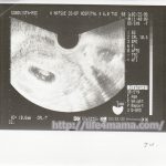 妊娠7週目のエコー画像